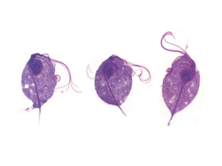 trichomonas-vaginalis